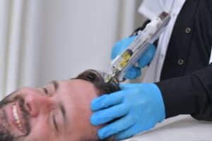טיפול PRP לשיער ב-PRPclinic גבר עובר הזרקה לקרקפת