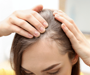 נשירת שיער אחרי לידה