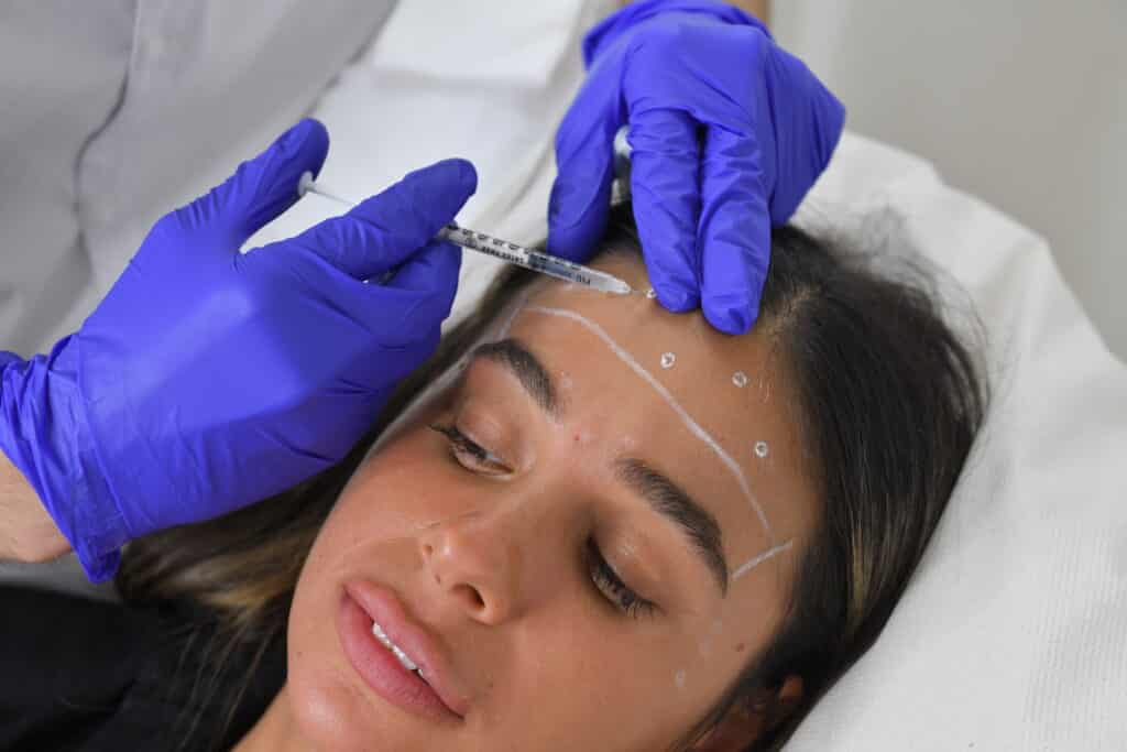הזרקת בוטוקס למצח ב-PRPclinic