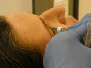 טיפול בפולינוקליאוטידים מזרע סלמון